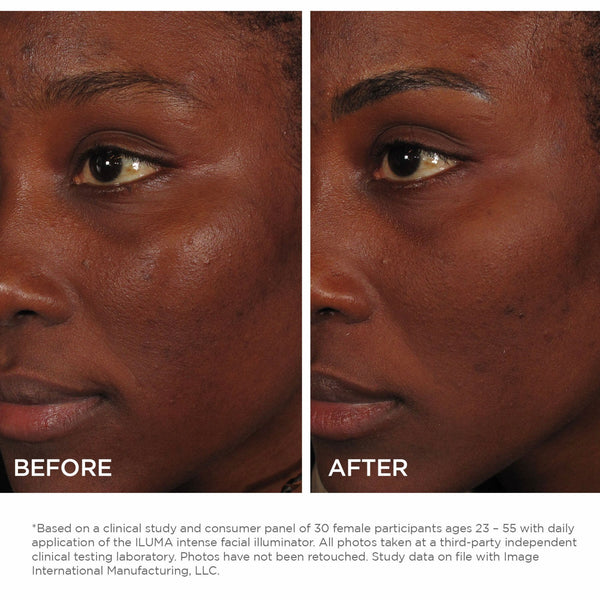 Iluma Intense Facial Iluminator - Image Skincare